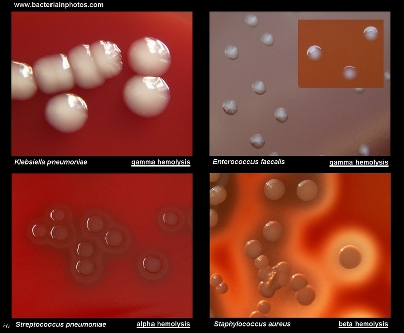 alpha, beta,gamma hemolysis